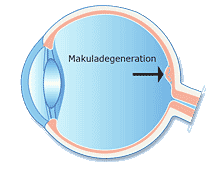 Intravitreale Injektion